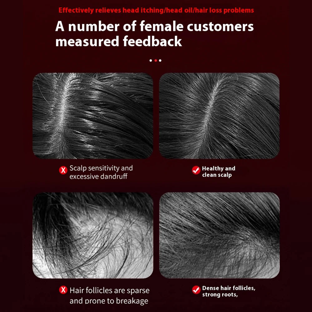 Electric Hair Regrowth Brush with Infrared Light Acupoint Scalp Massage Anti Hair Loss Liquid Oil Applicator Hair Care