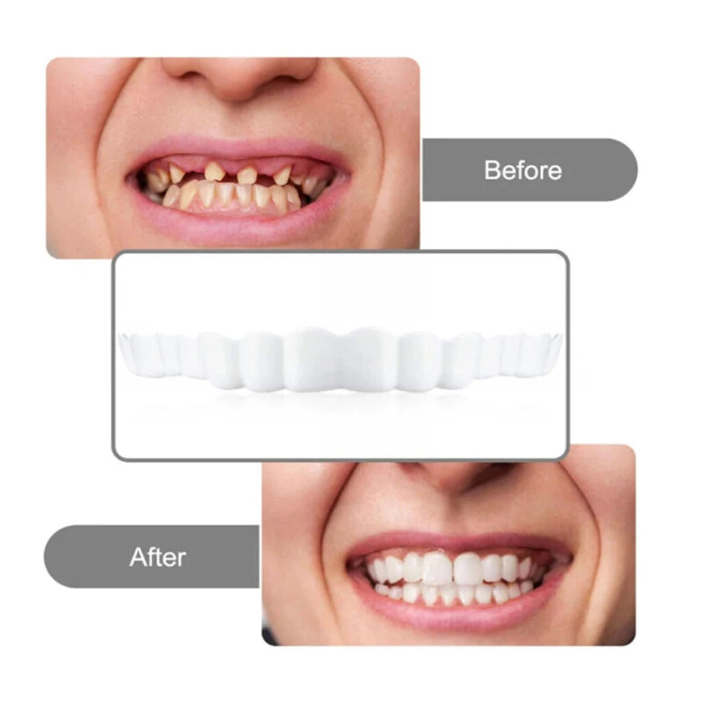 4-6 Pairs Upper&Lower Jaw Denture Dentures Teeth Denture Care Comfort Protect Your Teeth Perfect False Teeth for Men and Women