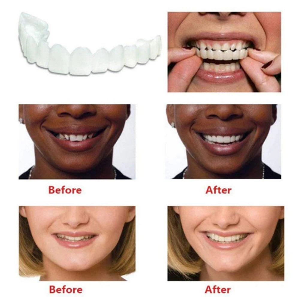4-6 Pairs Upper&Lower Jaw Denture Dentures Teeth Denture Care Comfort Protect Your Teeth Perfect False Teeth for Men and Women