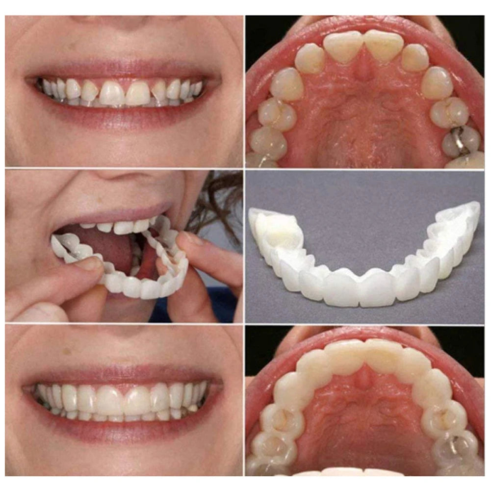 4-6 Pairs Upper&Lower Jaw Denture Dentures Teeth Denture Care Comfort Protect Your Teeth Perfect False Teeth for Men and Women